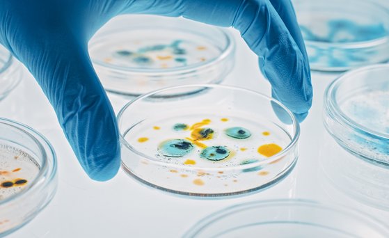 Mikrobiologie Hand trägt blauen Handschuh und hält Petrischle mit blau-gelber Kultur.