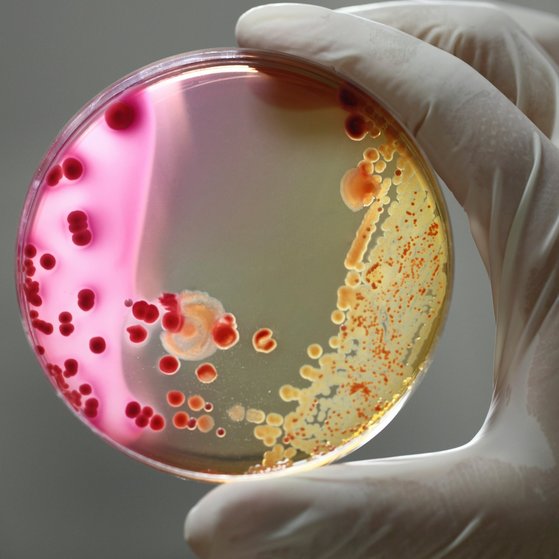 Bakterien Agarschale wird mit zwei Fingern hochgehalten.